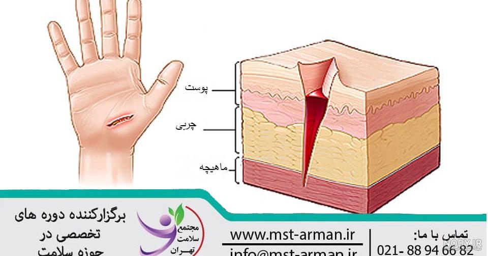 بیماری زبان سیاه چیست و چه خطراتی به دنبال دارد؟ | بهترین جراح گوش تهران