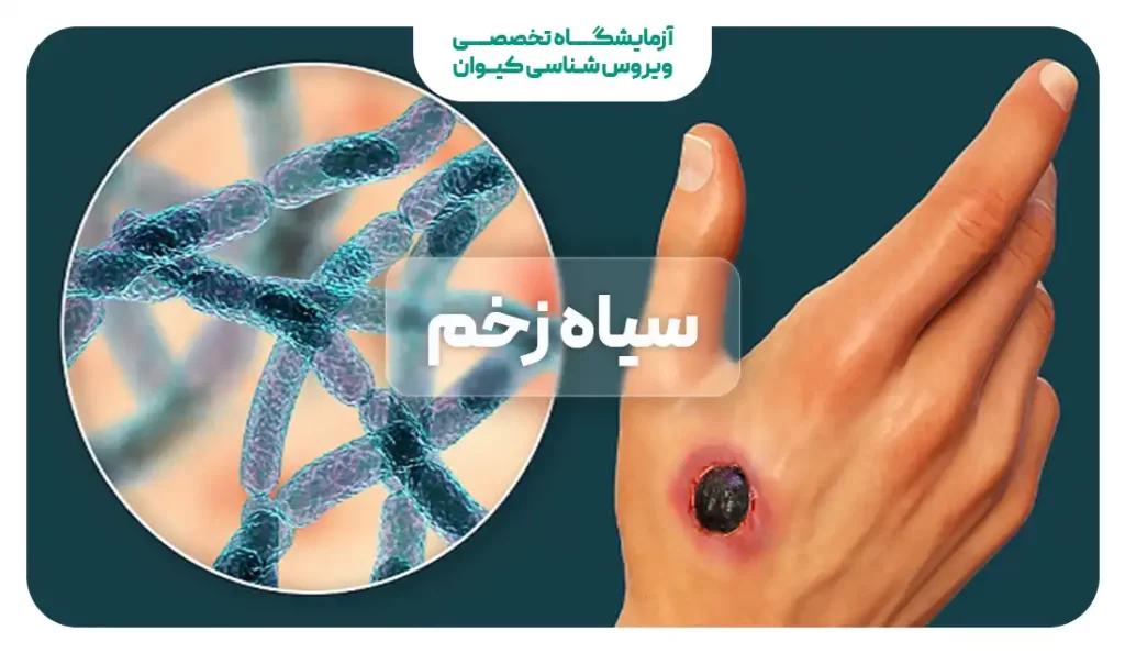 بیماری سیاه زخم و ۱۳ روش تشخیص و نجات از مرگ