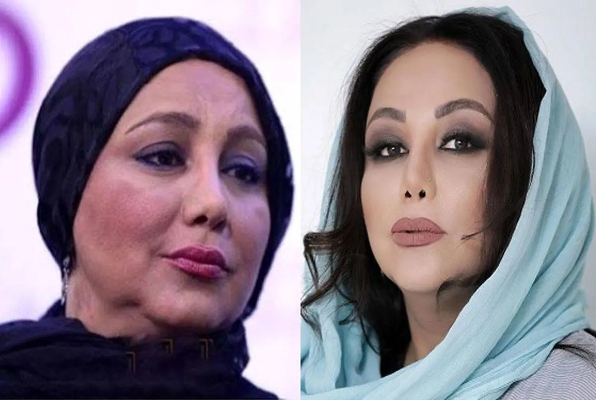 عکس بهار قبل از عمل - عکس نودی عکس بهار قبل از عمل - عکس نودی