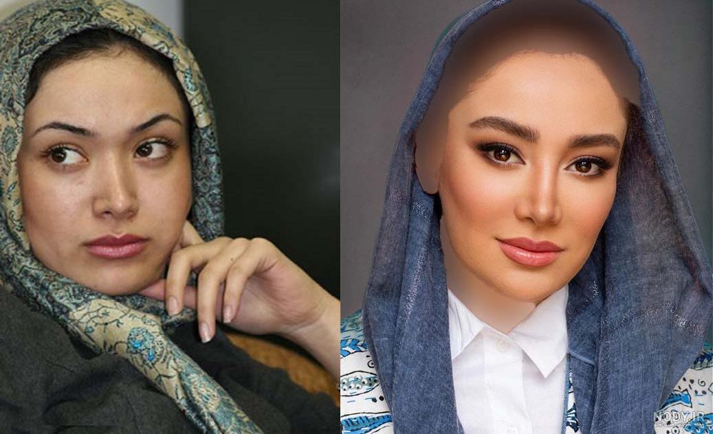 عکس/ تصویری از تغییرات جدید بهاره رهنما بعد از عمل لاغری عکس/ تصویری از تغییرات جدید بهاره رهنما بعد از عمل لاغری