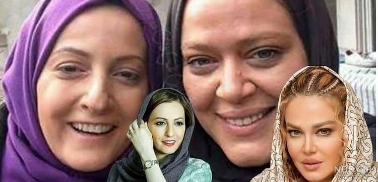 عکس جنجالی خانم بازیگر قبل از عمل زیبایی عکس جنجالی خانم بازیگر قبل از عمل زیبایی