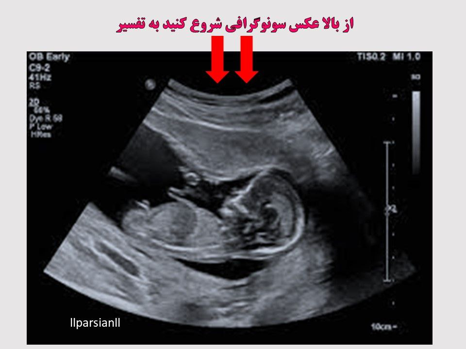 سونوگرافی جنین - رادیولوژی , سونوگرافی , ماموگرافی سونوگرافی جنین - رادیولوژی , سونوگرافی , ماموگرافی