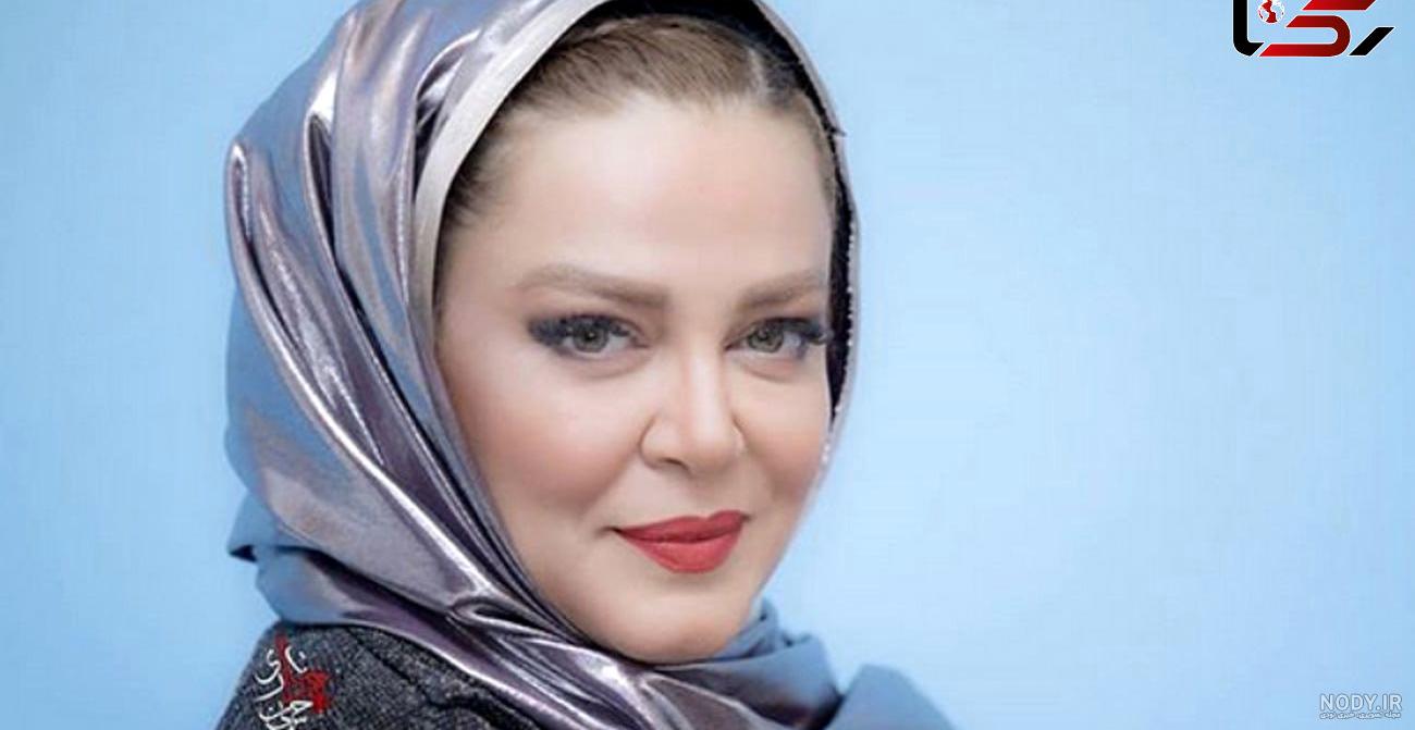 عکس های چهره قبل و بعد از عمل 10 هنرمند را ببینید+ تصاویر عکس های چهره قبل و بعد از عمل 10 هنرمند را ببینید+ تصاویر