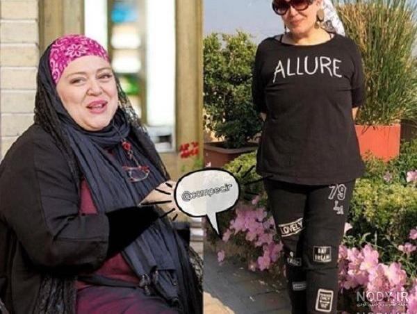 عکس “بهاره رهنما” قبل از عمل های زیبایی ! عکس “بهاره رهنما” قبل از عمل های زیبایی !
