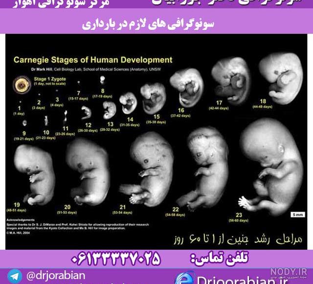 هفته ششم بارداری - فروشگاه سیسمونی نوزاد رامینا هفته ششم بارداری - فروشگاه سیسمونی نوزاد رامینا