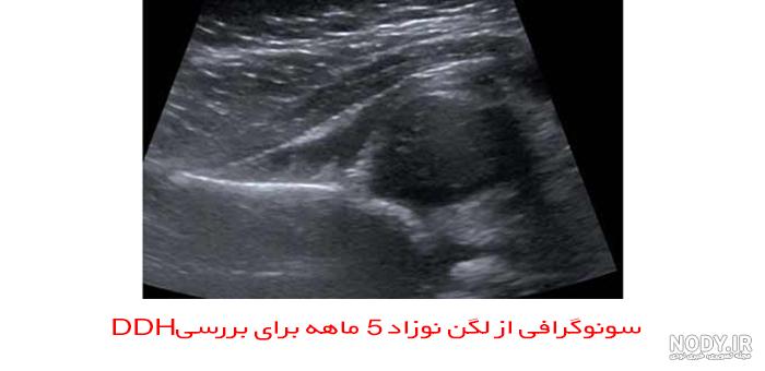 هفته پنجم بارداری نکات مهم و بایدها و نبایدها در هفته پنجم- توراهی هفته پنجم بارداری نکات مهم و بایدها و نبایدها در هفته پنجم- توراهی
