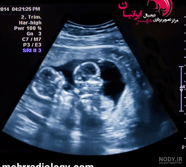 همه چیز درباره عکس رنگی جنین و پاسخ به سوالات متداول مادران بادار همه چیز درباره عکس رنگی جنین و پاسخ به سوالات متداول مادران بادار