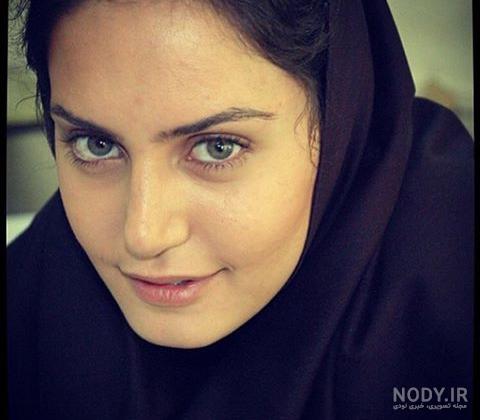 چهره قبل و بعد عمل بهاره افشاری لو رفت+ عکس | رصد روز | رسانه تخصصی بنگاههای اقتصادی چهره قبل و بعد عمل بهاره افشاری لو رفت+ عکس | رصد روز | رسانه تخصصی بنگاههای اقتصادی
