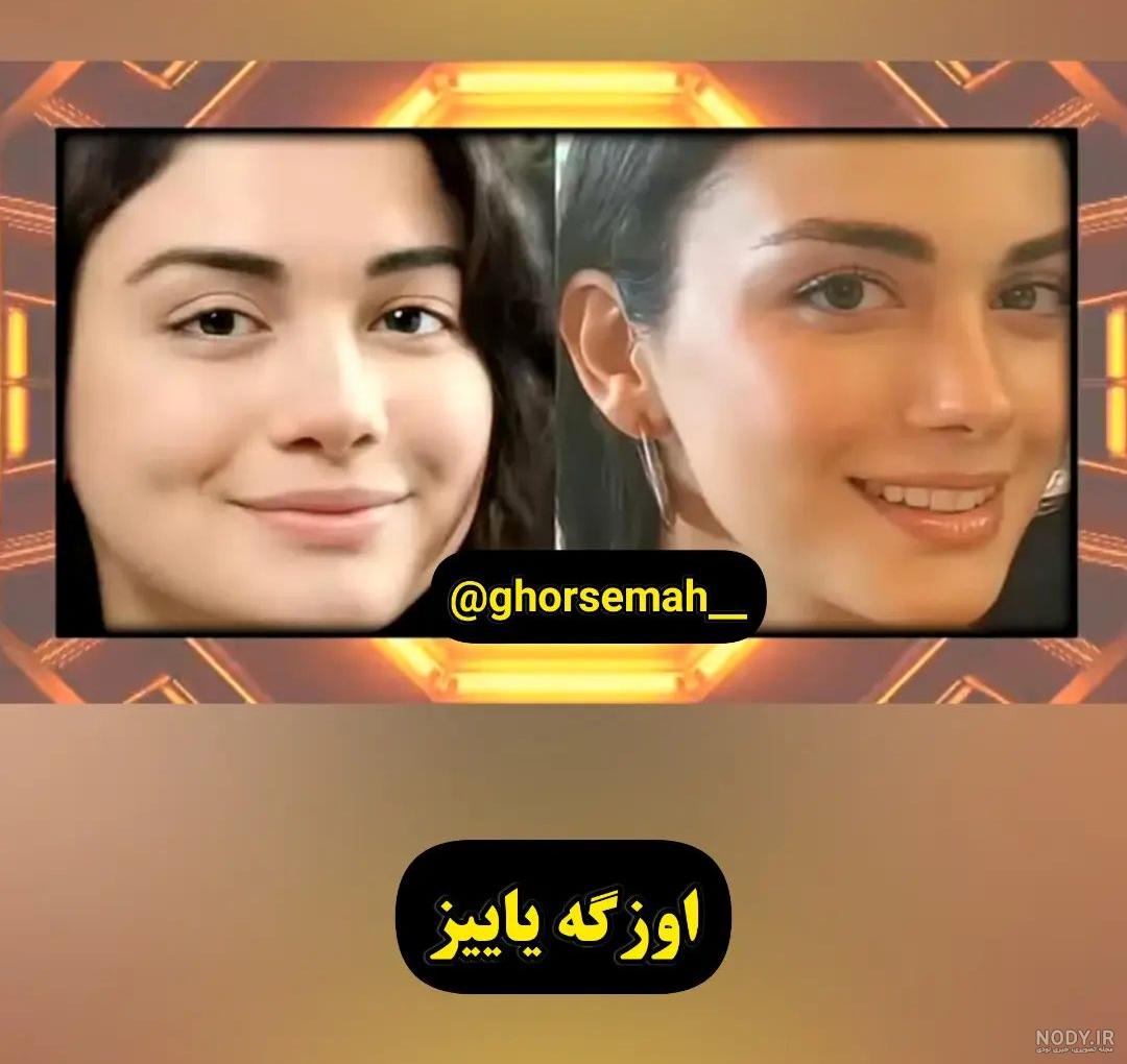 چهره قبل عمل زیبایی خانم بازیگران ترکیه ای / از هیلان تا هانده ارچل! + عکس های باورنکردنی - تماشاگرآنلاین چهره قبل عمل زیبایی خانم بازیگران ترکیه ای / از هیلان تا هانده ارچل! + عکس های باورنکردنی - تماشاگرآنلاین
