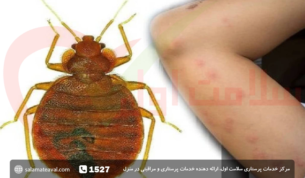 عکس پسر بچه با ساس بند عکس پسر بچه با ساس بند