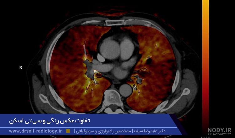 رادیولوژی و سونوگرافی مرکزی اصفهان رادیولوژی و سونوگرافی مرکزی اصفهان