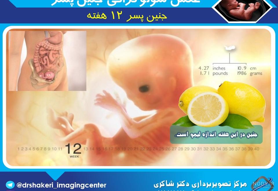 سونوگرافی آنومالی چیست؟ |سونوگرافی آنومالی|غربالگری انومالی اسکن سونوگرافی آنومالی چیست؟ |سونوگرافی آنومالی|غربالگری انومالی اسکن