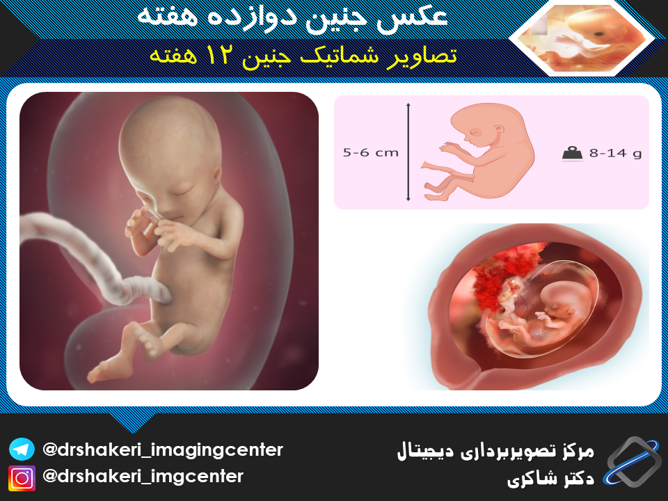 سونوگرافی رنگی جنین یا سونوگرافی داپلر چه زمانی لازم است و هزینه آن چقدر است؟ سونوگرافی رنگی جنین یا سونوگرافی داپلر چه زمانی لازم است و هزینه آن چقدر است؟