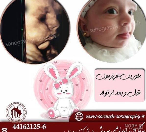 سونوگرافی سه بعدی و چهار بعدی جنین و خطرات آن+عکس سونوگرافی سه بعدی و چهار بعدی جنین و خطرات آن+عکس