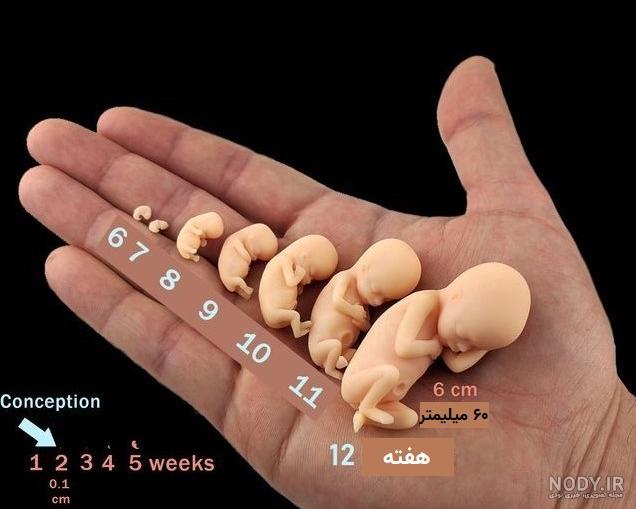 عکس رنگی از صورت جنین عکس رنگی از صورت جنین