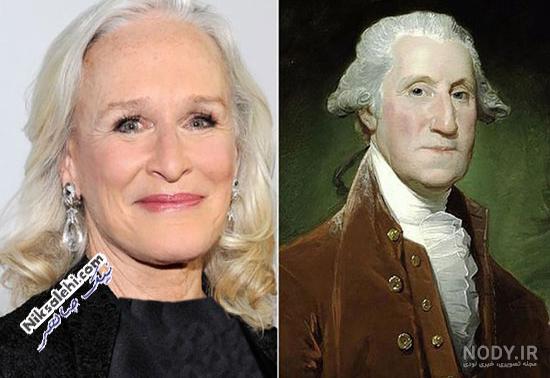 عکسی ترسناک از مغز یک پیرزن 80 ساله عکسی ترسناک از مغز یک پیرزن 80 ساله