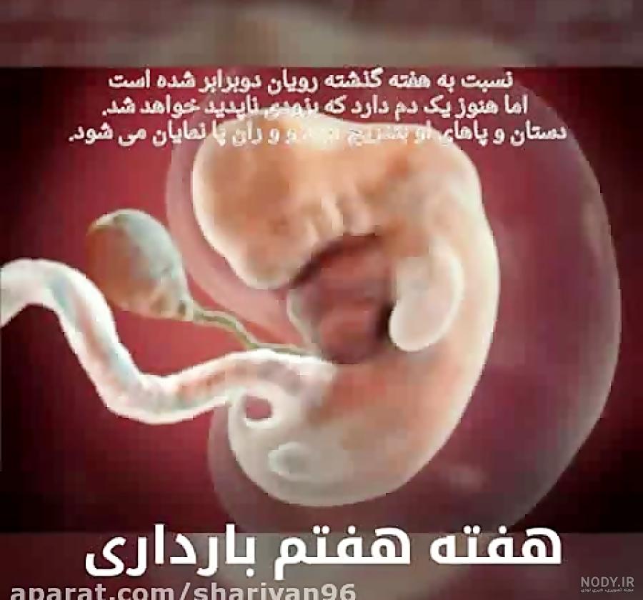 انواع سقط جنین را بشناسید انواع سقط جنین را بشناسید
