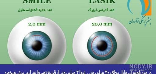 بهترین جراح لازک در تهران کیست؟ | عمل اصلاح دید لازک - دکتر پریسا اشترنخعی بهترین جراح لازک در تهران کیست؟ | عمل اصلاح دید لازک - دکتر پریسا اشترنخعی