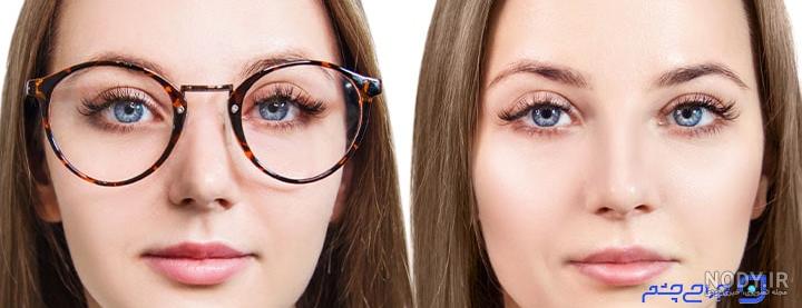 لیزیک چیست ؟ هر آنچه در مورد عمل لیزیک باید بدانید؛ عملی که در عرض چند  دقیقه بینایی کامل را به شما برمی‌گرداند | بلاگ لوناتو