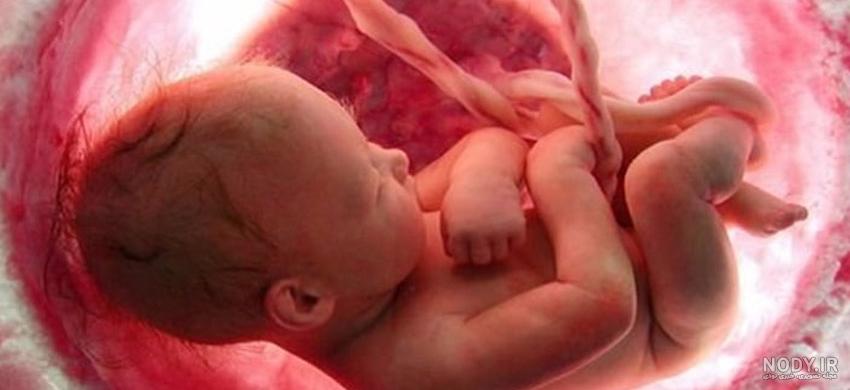 نشانه‌ های سقط جنین به تفکیک هر ماه - علائم و عوامل مؤثر - دکتر ویدا یوسفیان