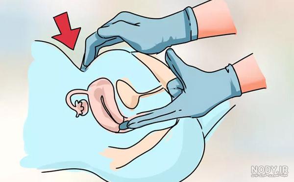در هفته ششم بارداری چه علائمی سراغتان می آید و جنین چه اندازه می شود؟ در هفته ششم بارداری چه علائمی سراغتان می آید و جنین چه اندازه می شود؟