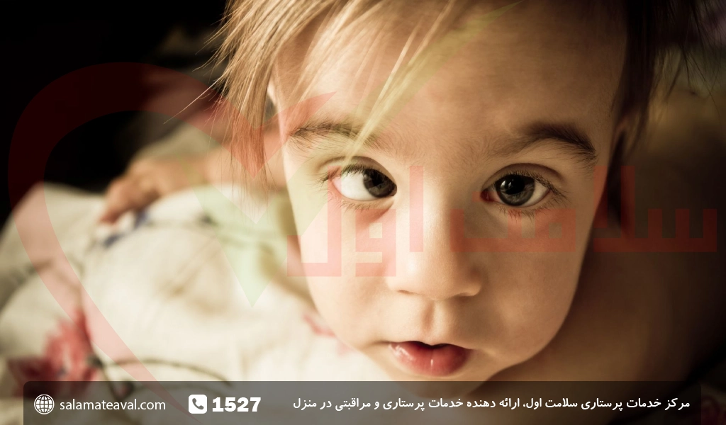 بهتری سن برای درمان انحراف چشم در کودکان - دکتر فرزاد پاکدل بهتری سن برای درمان انحراف چشم در کودکان - دکتر فرزاد پاکدل