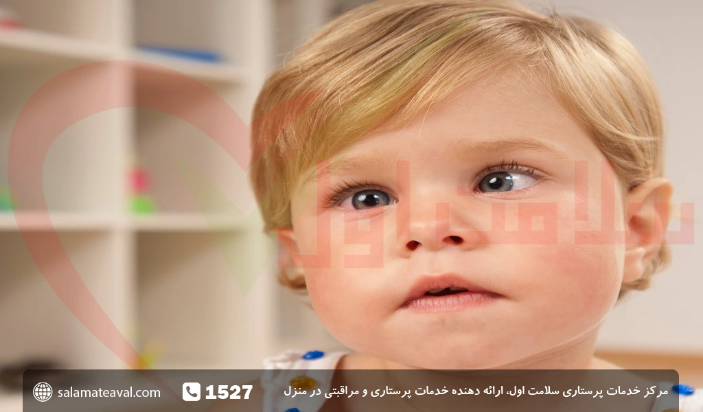 عکس چشم پزشکی کودکان