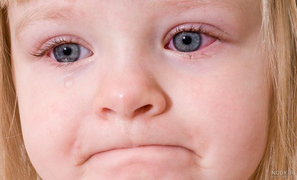 معرفی 10 چشم پزشک کودکان در تهران با نشانی مطب و تلفن - دکترعینک معرفی 10 چشم پزشک کودکان در تهران با نشانی مطب و تلفن - دکترعینک