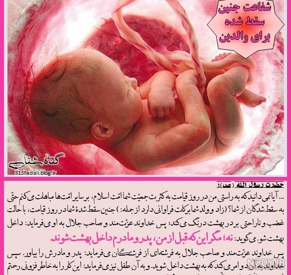 5 دلیل اصلی سقط جنین و راه‌های درمان آن | پذیرش۲۴