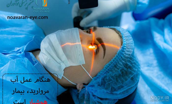 آب مروارید | علائم، دلایل، پیشگیری و درمان | پذیرش۲۴ آب مروارید | علائم، دلایل، پیشگیری و درمان | پذیرش۲۴