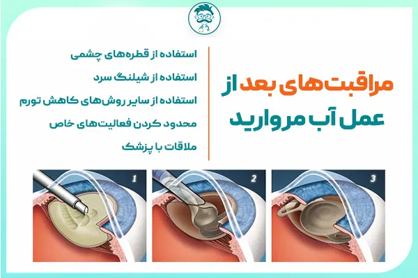 آشنایی با آب مروارید (کاتاراکت) و تاثیرات آن بر بینایی | درمان آب مروارید | دکتر مریم روشنی آشنایی با آب مروارید (کاتاراکت) و تاثیرات آن بر بینایی | درمان آب مروارید | دکتر مریم روشنی