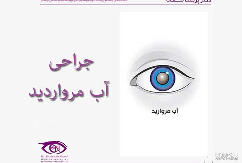 روش های درمان آب مروارید با طب سنتی و پیشگیری از آب مروارید