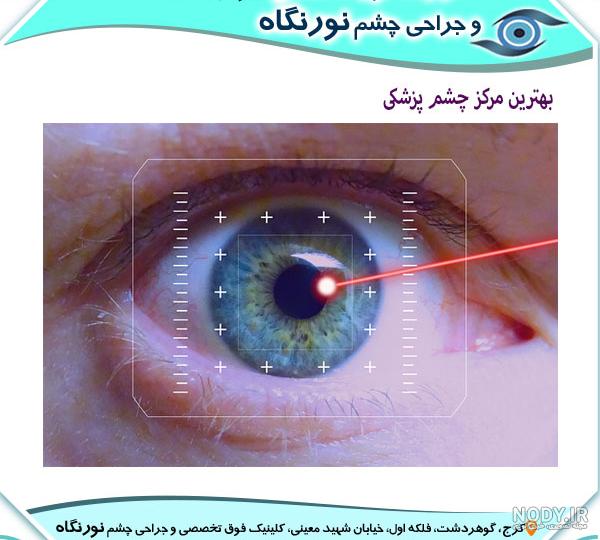 علائم چشم پزشکی و دانلود علامت ها و تابلو برای سنجش بینایی در منزل