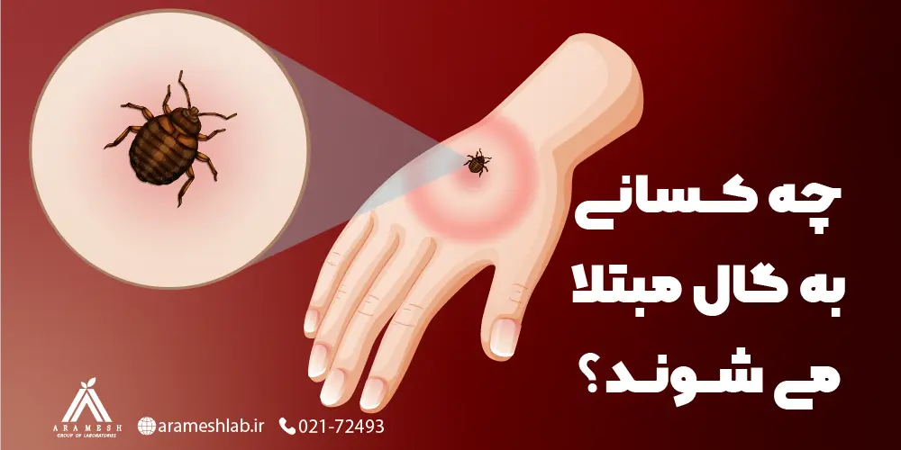 علائم گال در کودکان | الو راستین سلامت علائم گال در کودکان | الو راستین سلامت