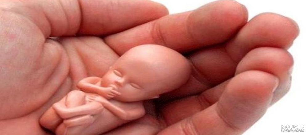 عکس جنین سقط شده هفت هفته ای