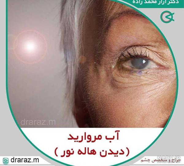 عکس عمل چشم اب مروارید عکس عمل چشم اب مروارید