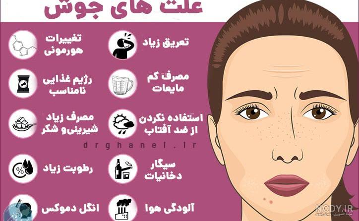 بایگانی‌های جوش صورت | کلینیک تخصصی پوست و مو آتریسا