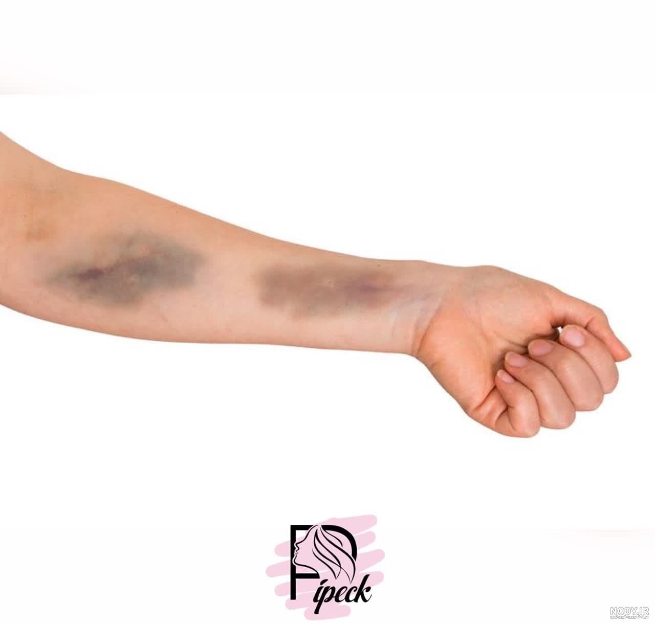 تصاویر چشم کبود تصاویر چشم کبود
