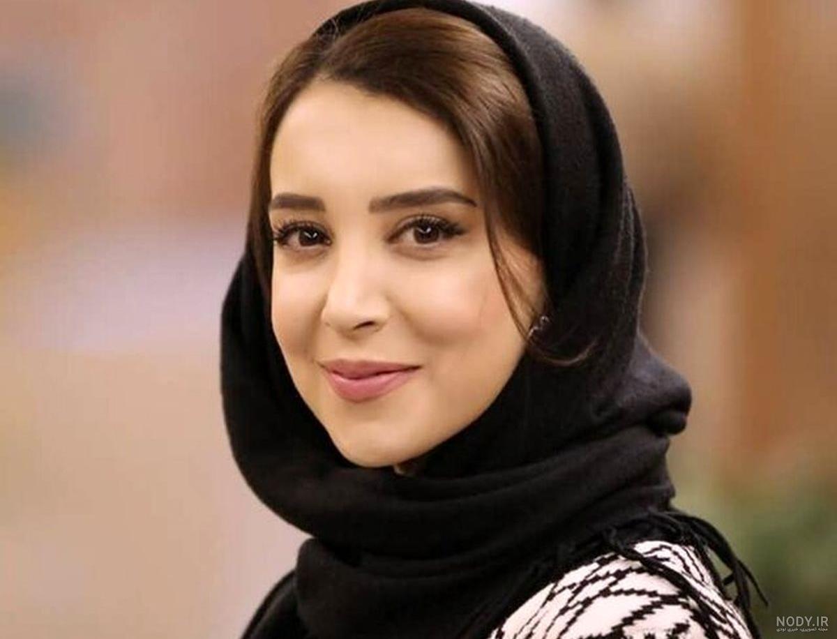 تغییر چهره باورنکردنی سحر جعفری جوزانی بعد از فلج صورت + عکس های قبل و بعد! تغییر چهره باورنکردنی سحر جعفری جوزانی بعد از فلج صورت + عکس های قبل و بعد!