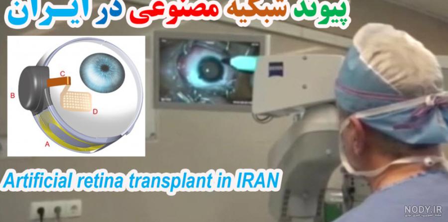 عکس ربات چشم لیزری