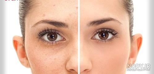 عکس فیک کبودی - عکس نودی عکس فیک کبودی - عکس نودی