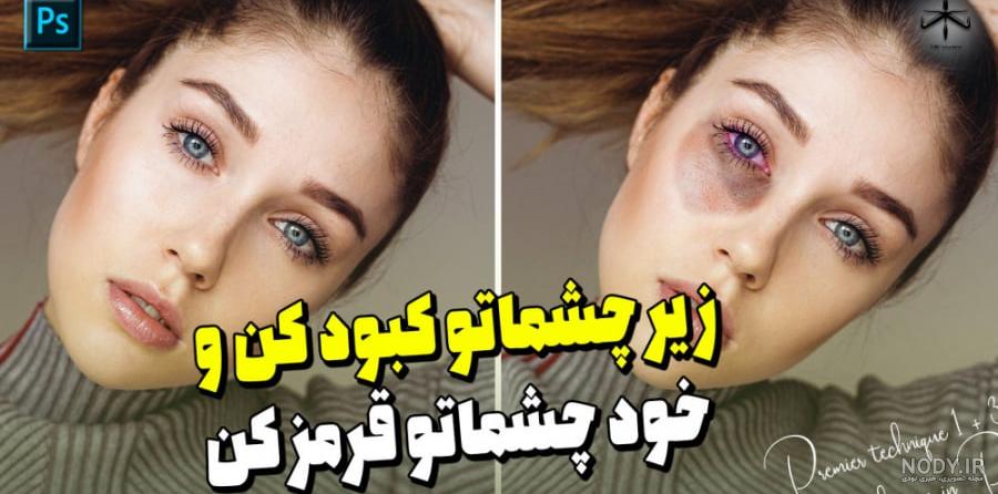 عکس فیک کبودی - عکس نودی عکس فیک کبودی - عکس نودی