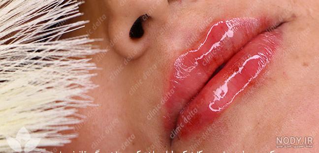 عکس فیک کبودی - عکس نودی عکس فیک کبودی - عکس نودی