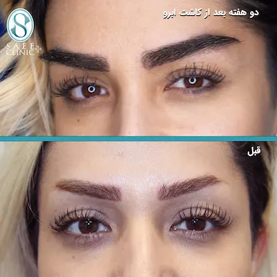 عکس پروفایل چشم و ابرو | عکس چشم گریان و صورت با نقاب شیک عکس پروفایل چشم و ابرو | عکس چشم گریان و صورت با نقاب شیک