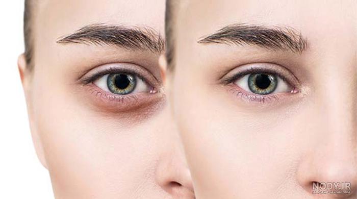 عکس های چشم / بهترین تصاویر چشم [پیشنهادی] | تاوعکس
