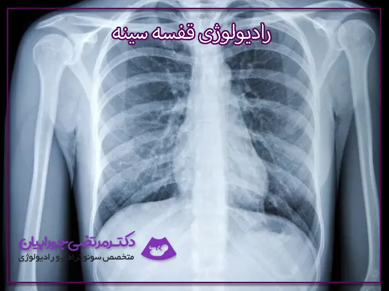 اسکن قفسه سینه می‌تواند ناراحتی قلبی را هم تشخیص دهد - خبرگزاری مهر | اخبار  ایران و جهان | Mehr News Agency