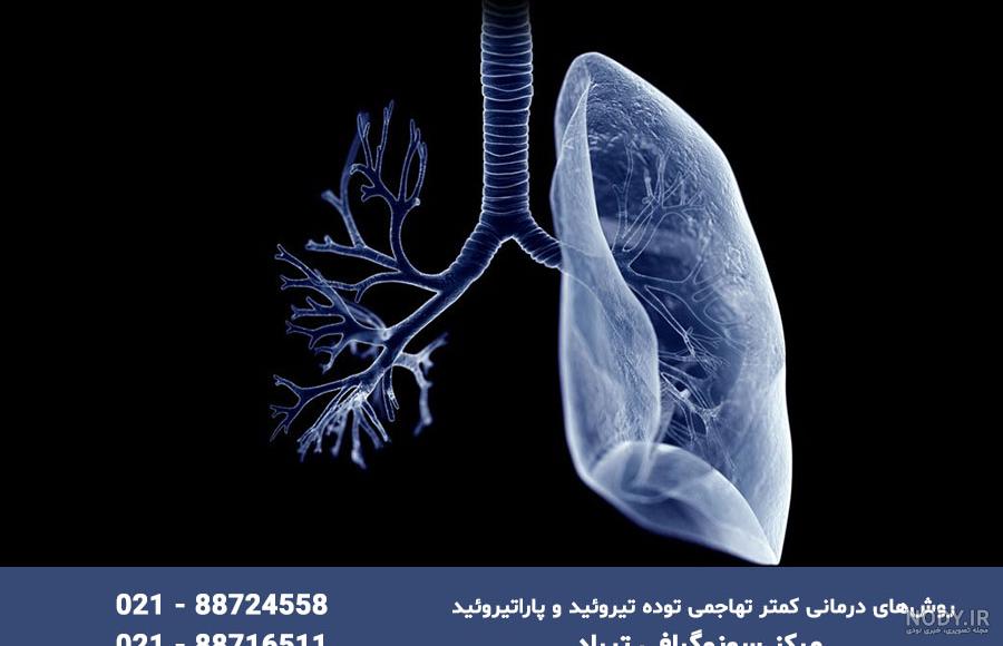 درگیری ریه در کرونا؛ از علائم تا درمان