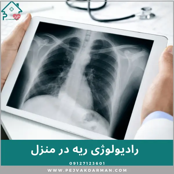 رادیولوژی ریه و قفسه سینه در منزل تهران کرج اصفهان شیراز مشهد