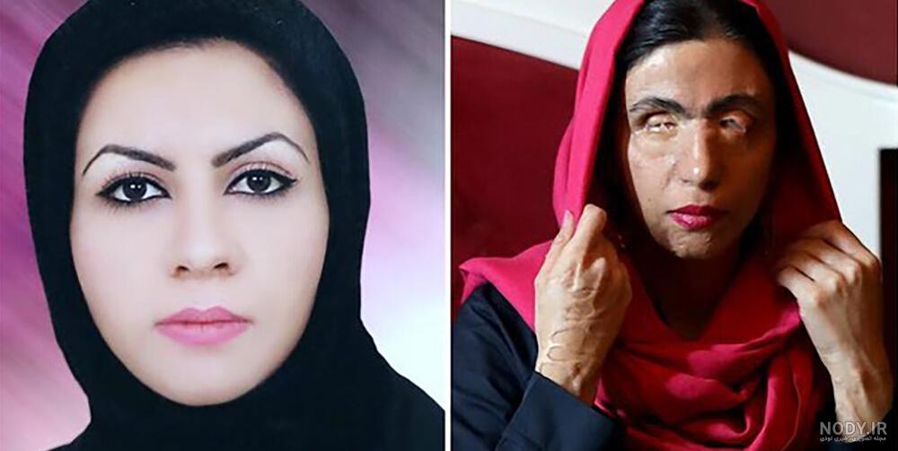 عکس دختر زیبا ایرانی ۱۷ ساله