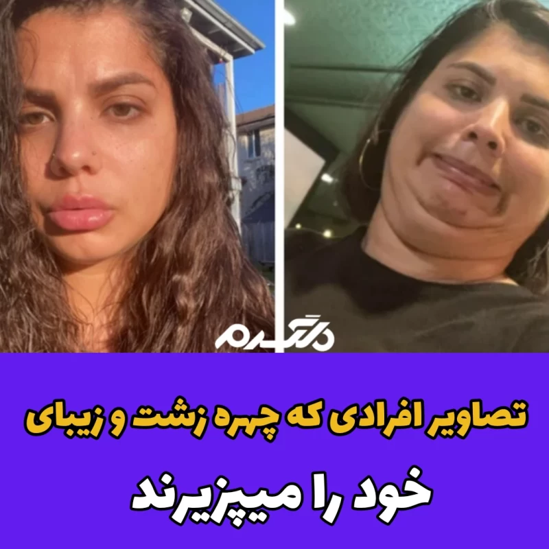 زشت ترین و موفق ترین دختر دنیا+ عکس و داستان شوکه کننده